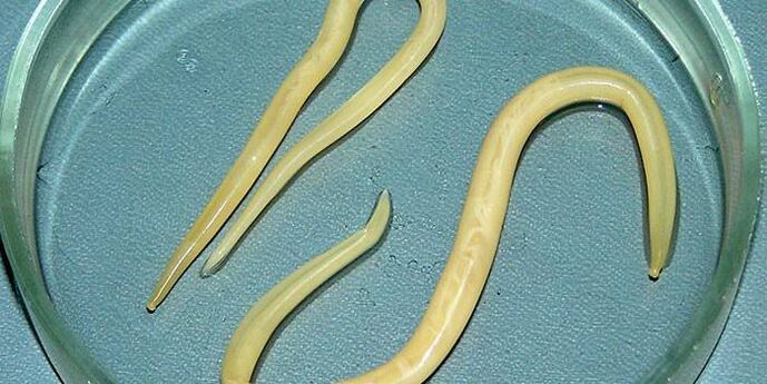 Menschliche Spulwürmer in einer Petrischale - parasitieren an den Wänden des Dünndarms
