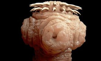 Arten von Parasiten im menschlichen Körper
