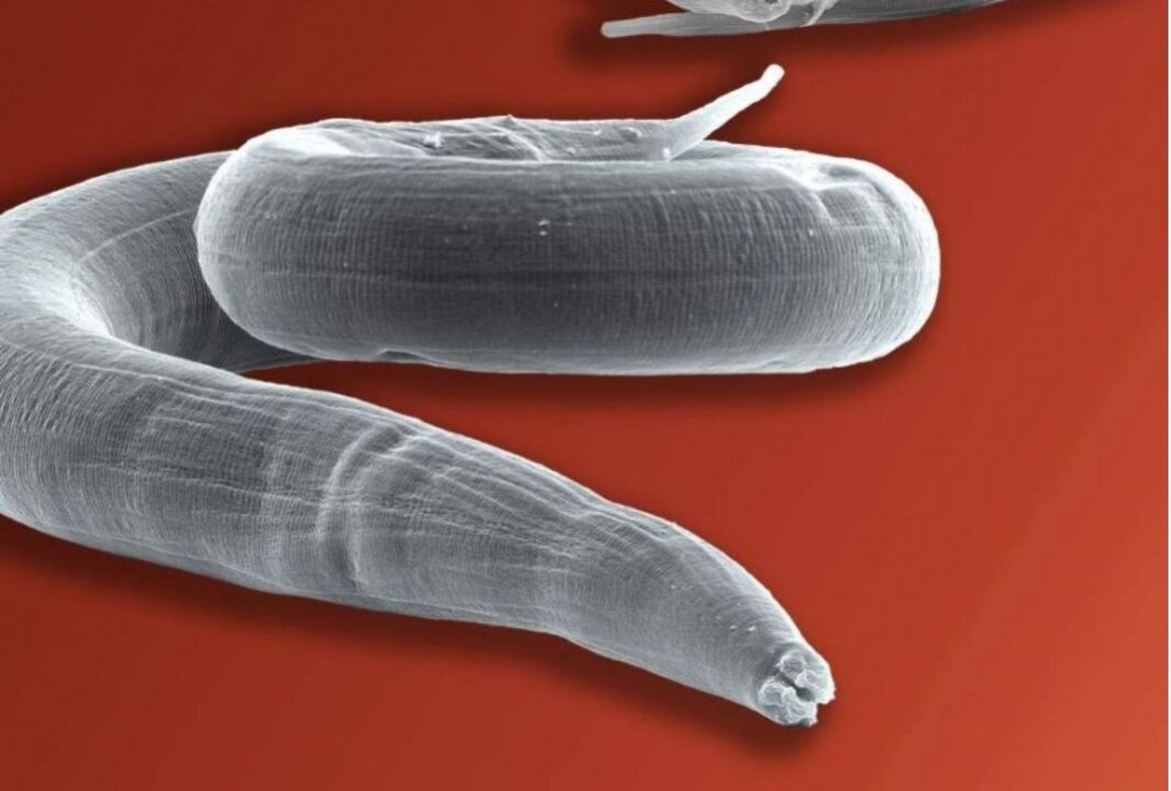 Madenwurm aus dem menschlichen Körper