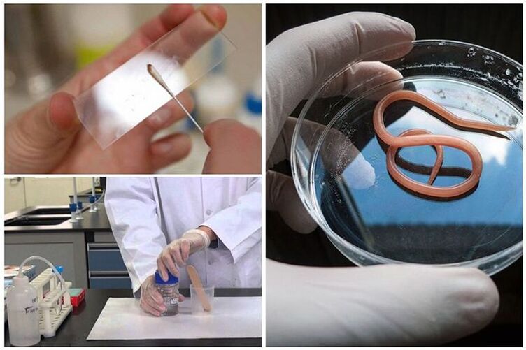 Tests auf das Vorhandensein von Würmern im Körper