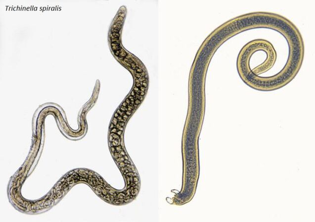 Trichinen